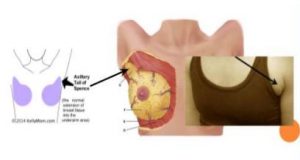 Mammary Glands Anatomy